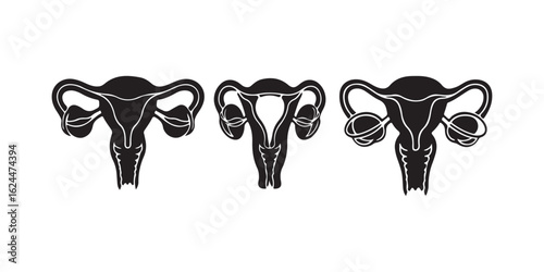 Three black uterus illustrations aligned horizontally on a white background image design art