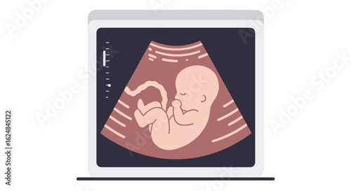 Fetus Inside Womb on Ultrasound Screen in Clinic Diagnosing Pregnancy Status