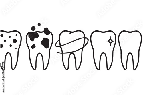 Four illustrations showing the stages of dental health, from decay to sparkling clean teeth, highlighting oral hygiene and treatment, dental care graphics