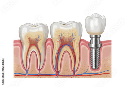 Discover the intricate dental anatomy showcasing healthy teeth alongside a modern, precisely placed dental implant with visible roots and blood vessels