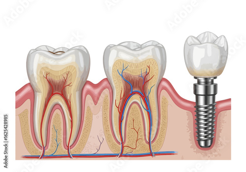 Discover the intricate anatomy of healthy teeth and the revolutionary dental implant procedure for restoring smiles and oral health with stunning clarity