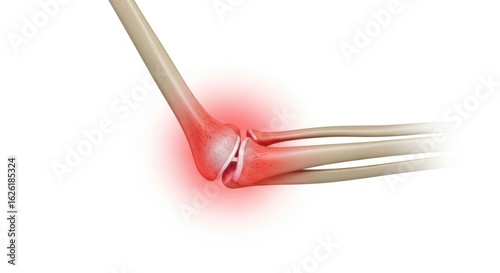 Illustration of an elbow joint with red highlighting indicating pain or inflammation on white background