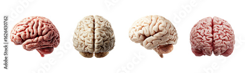 Realistic Human Brain PNG Bundle – Isolated Views on White Background