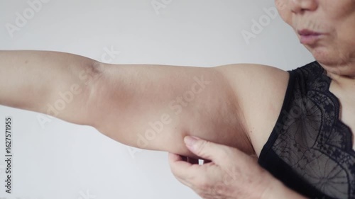 Cropped shot of elderly woman with excess fat on upper arm and liposuction or plastic surgery marks on white background. Flabby and saggy muscles. 