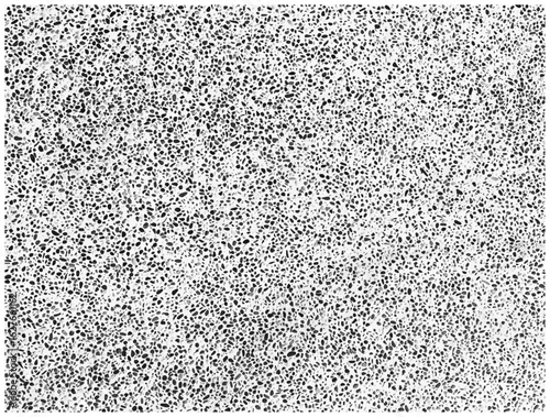 White Background with Black Speckles or Ink Splatter Texture（白地に黒いブツブツがびっしりある背景）