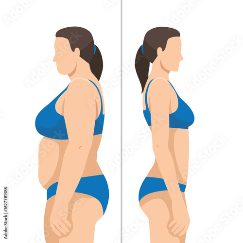 Illustration of a visual comparison of a woman's body before and after weight loss progress.