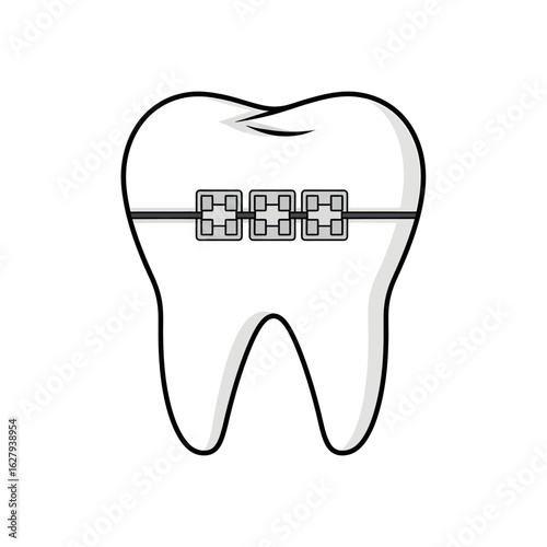Illustration of a single tooth with braces, showing the brackets and wire, isolated on a white background.