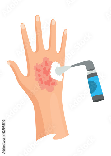 Hands injured skin and procedures of bandaging. First aid for wound. Medicine cure or treatment. First emergency help for human hand trauma