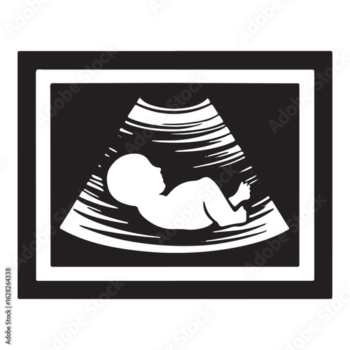 Ultrasound Silhouette of Fetus, Medical Vector Illustration, Pregnancy Icon, Baby Symbol, Scan