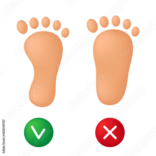 Healthy foot and flatfoot. Vector illustration isolated on white background.