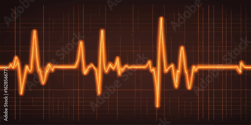 EKG cardiogram monitor showing a green heartbeat pulse line on a medical health technology graph