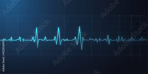 Medical EKG heartbeat pulse monitor graph with a blue cardiogram line