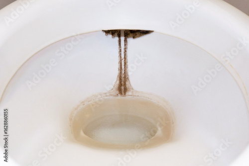 Canvastavla 洋式トイレ 便器の黒ずみ