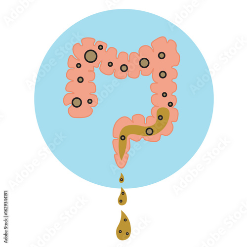 Minimalist vector illustration on bowel incontinence, showing key symptoms like leakage, urgency, diarrhea, and related conditions such as IBS, Crohn’s, and rectal disorders icon