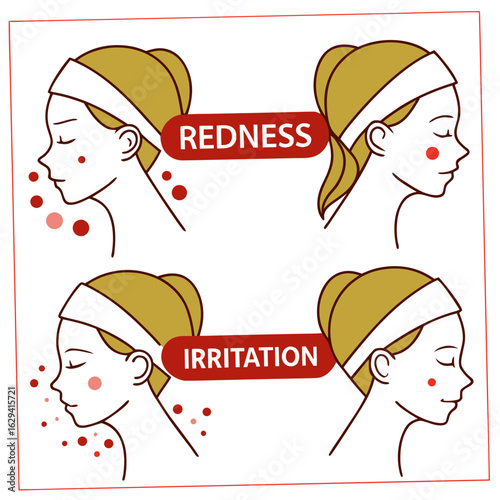Illustration of a woman s face showing skin redness and irritation with explanatory text labels