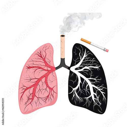 Lung Health and Smoke's Shadow: a stark illustration exposes the impact of smoking on lung health.
