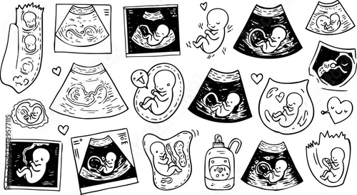 Cute hand-drawn doodles of baby fetuses, ultrasound scans, and pregnancy-related symbols in black and white line art, illustrating early development and maternity.