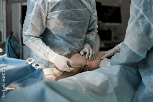 Medical procedure of endovenous laser treatment for varicose veins on lower limbs, modern healthcare.
