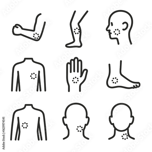 Bruise Icon Set. Outline icon set of bruise locations: arm bruise, leg bruise, face bruise, back bruise, hand bruise, foot bruise,