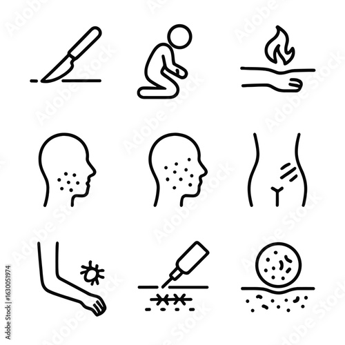 Scar Causes Icons. Outline icon set of scar causes: surgery, injury, burn, acne, chickenpox, stretch, insect bite, tattoo removal,