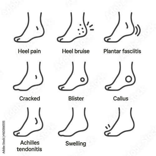 Heel Health Icons. Outline icon set of heel injuries and conditions: heel pain, heel bruise, plantar fasciitis, heel spur, cracked
