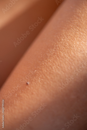 Close-up of natural human skin with visible pores, body hair and small imperfection in warm natural lighting