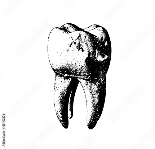 Vector Detailed of a damaged molar tooth with roots.