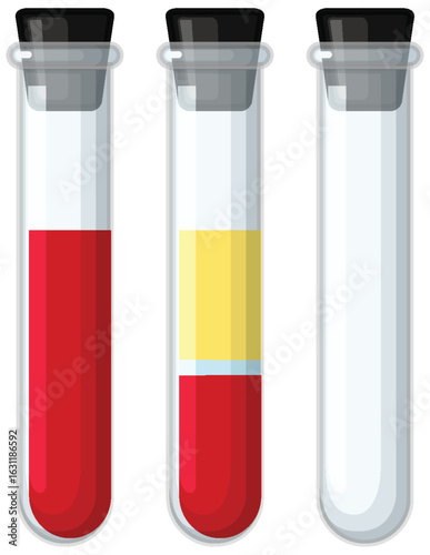 Blood Sample Separation in Laboratory Test Tubes