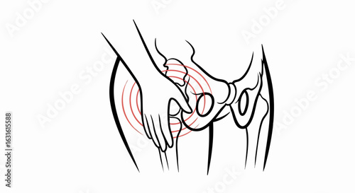 Hip pain illustration showing woman holding her aching hip joint.  Illustration depicts anatomical structure of hip bone with highlighted painful area. Medical image for healthcare professionals,