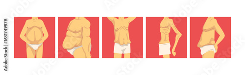 Male Torso with Sagging Belly and Soft Muscles Vector Set