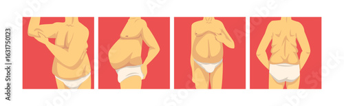 Male Torso with Sagging Belly and Soft Muscles Vector Set