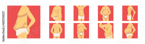 Male Torso with Sagging Belly and Soft Muscles Vector Set