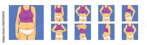 Female Torso with Sagging Belly and Soft Muscles Vector Set