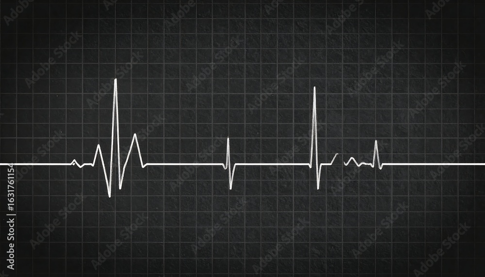 Naklejka premium Chalkboard EKG Heartbeat Rhythm Graphic