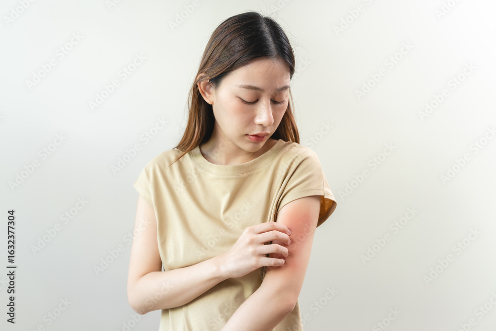 Obraz premium young woman scratching on her arm and has a red rash irritation on her skin from dust intolerance.