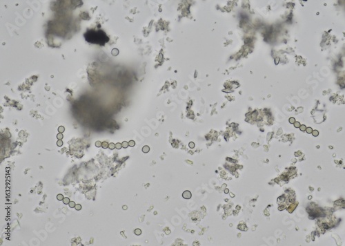 soil microorganisms under a microscope including amoeba, flagellates, nematodes, fungi, bacteria	