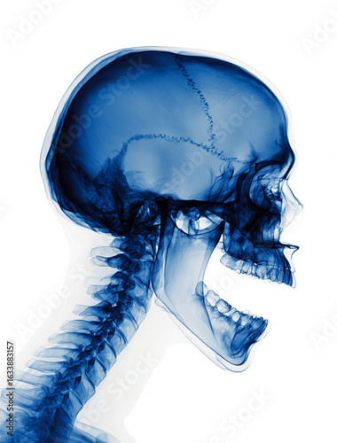 Side view x-ray of skull with mouth wide open, transparent blue on white background