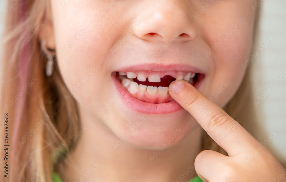 Obraz premium Happy girl showing missing tooth, smiling child, baby tooth fell out, childhood moment waiting for toothfairy, growing up, natural process, cute Toothless smile expression