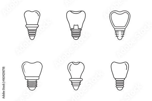 Dental Implant Illustrations Showcase Modern Dentistry and Oral Health Solutions for Tooth Replacement Options