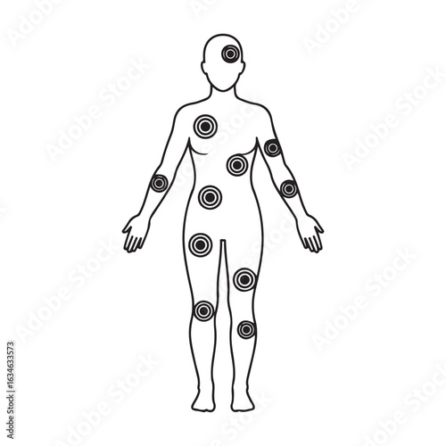 Fibromyalgia pain points of body aches, vector illustration