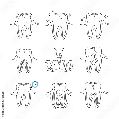 Dental health and oral hygiene illustrations representing different tooth conditions and treatments