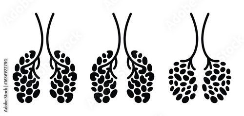 Diagram of healthy and diseased alveoli in human lungs