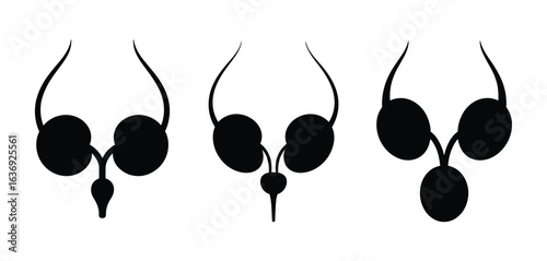 Diagram of the male reproductive system with three variations