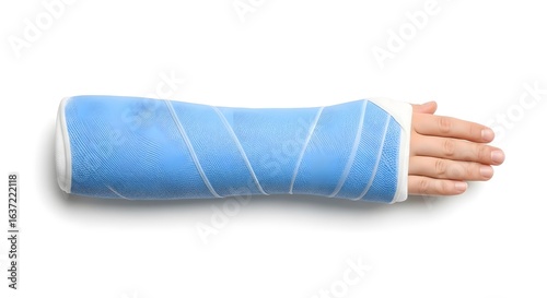 Arm in Blue Cast on White Background