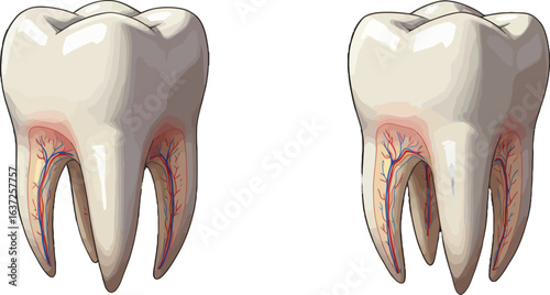 Comparative dental illustration showcasing internal structure of healthy tooth