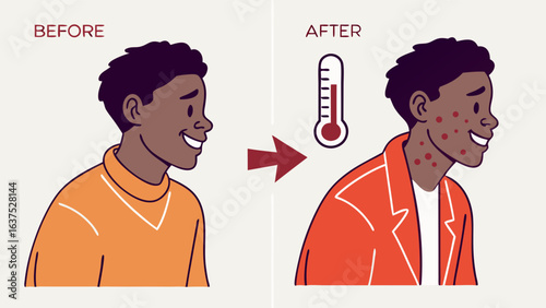 Before and After Illustration of a Person with a Fever.