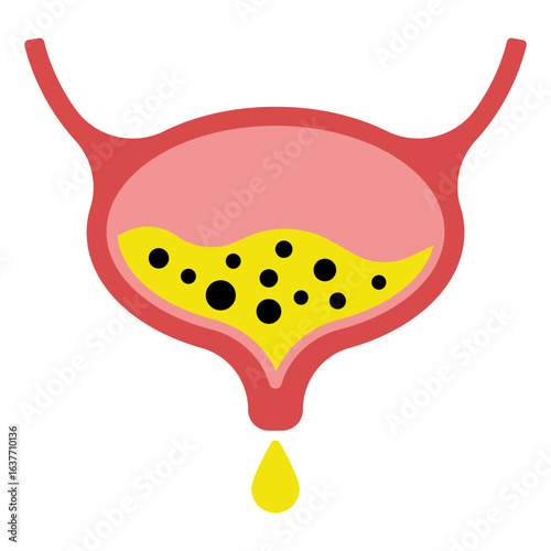 Human bladder anatomy. Empty and full urinary bladder. Vector illustration isolated on white background.