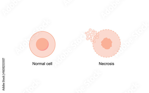 Necrosis, Pathologic Cell Death, vs normal cell. Vector illustration