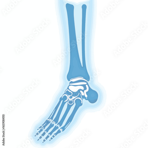 X-ray illustration of fractured forearm bone on white background, medical study