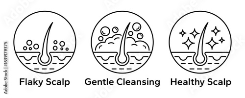 Anti dandruff icon set. Strong healthy hair line icons. Anti dandruff logo, label, badge, symbol, sign, circle, line, vector, isolated illustration. Anti dandruff label for product packaging design.